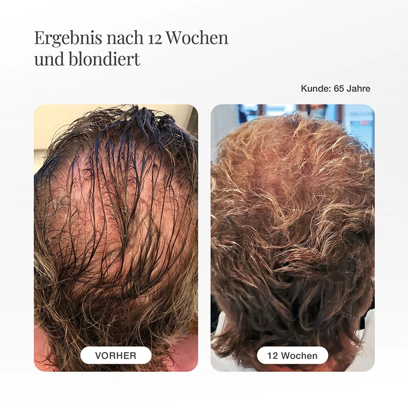 YXO Haarserum für Männer